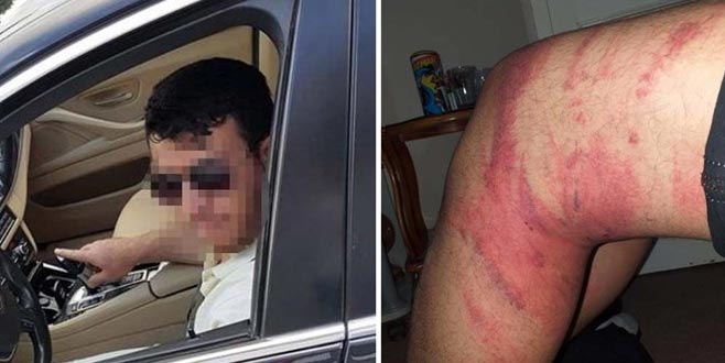 Çırağa triger kayışlı dayağa tahliye