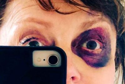 Ünlü oyuncu tanınmaz halde! Son paylaşımıyla yürekleri ağza getirdi!