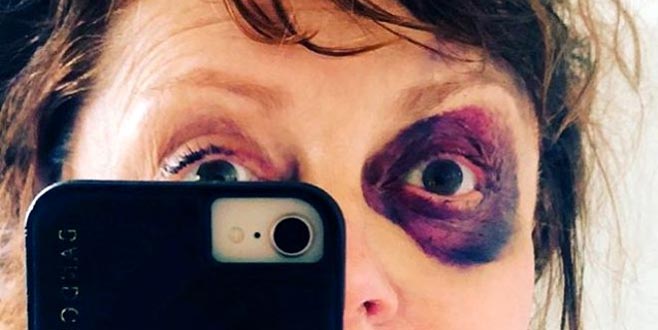 Ünlü oyuncu tanınmaz halde! Son paylaşımıyla yürekleri ağza getirdi!