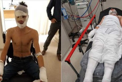 Evi kundaklamaya çalışırken bu hale geldiler