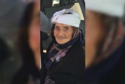 Sokak köpeği yaşlı kadının yüzünü parçaladı