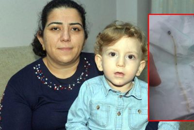 Bebeğin göbeğinde kateter unuttular