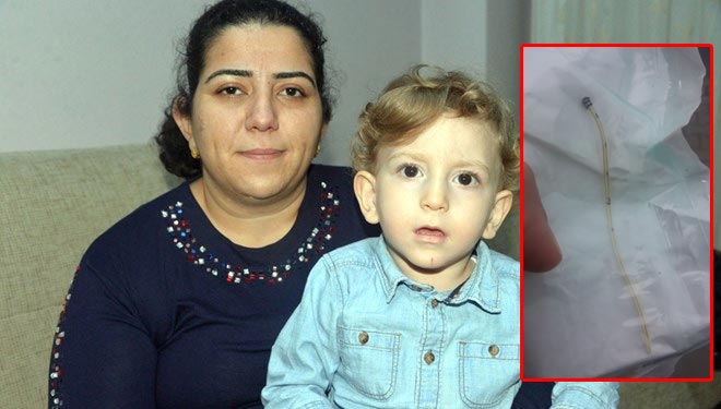 Bebeğin göbeğinde kateter unuttular
