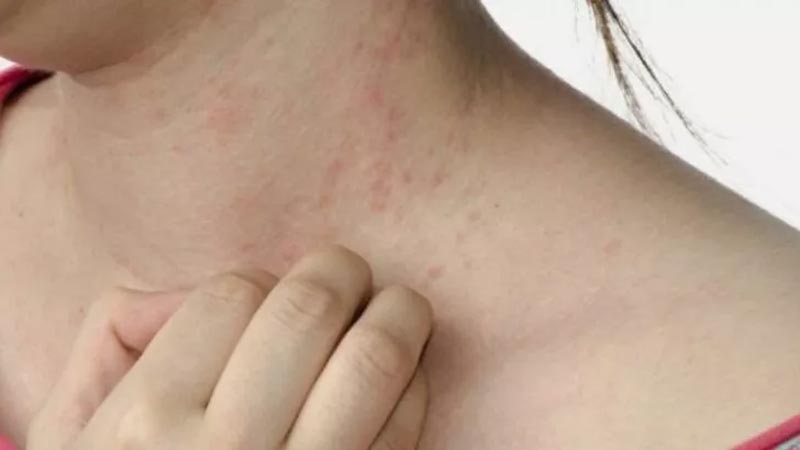 Vücuttaki parazit belirtileri neledir? Vücuttaki parazit belirtileri neledir?