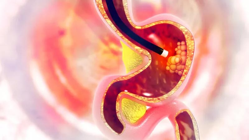 Sağlık Bakanlığı devreye girdi! Bu işlem öldürüyor mu? Sağlık Bakanlığı devreye girdi! Bu işlem öldürüyor mu?