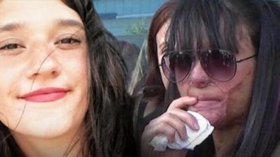 Berfin’in yüzünü asitle yakan caninin cezası belli oldu!