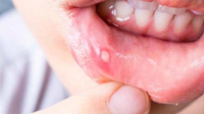 Soğanı dudağınızda 5 dakika boyuncu bekletirseniz…