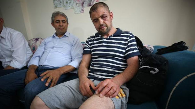Bursa'nın Gemlik ilçesinde ,Gazi Ömür Karaman'ı (41) bir kafeteryada ayağını