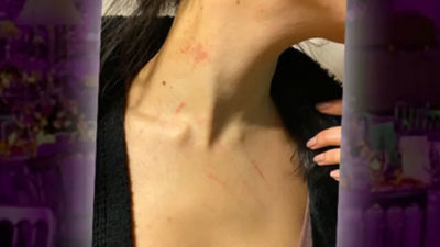 Düğünde cinsel saldırı skandalı