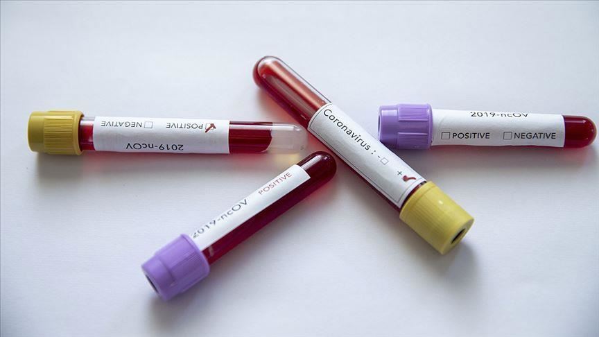 ABD’de koronavirüs salgınında ölenlerin sayısı 593 oldu