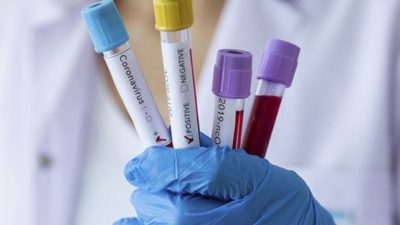 İtalya’da koronavirüsten ölenlerin sayısı 631’e yükseldi