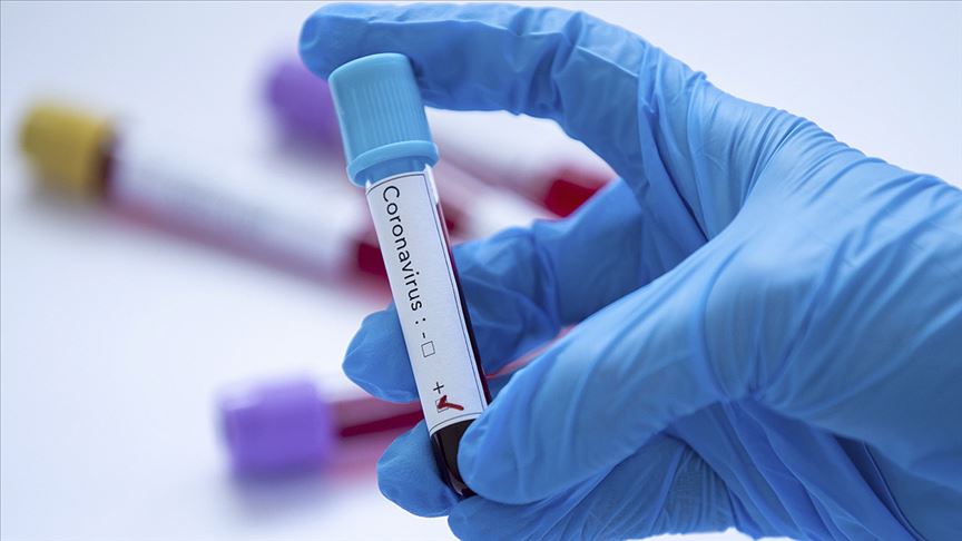 ABD’de Gizli Servis çalışanında yeni tip koronavirüs görüldü