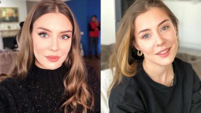 Ege Kökenli’den estetik itirafı!