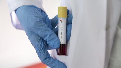 Bilim insanları tespit etti! Koronavirüs kendine yeni bir yaşam alanı daha buldu