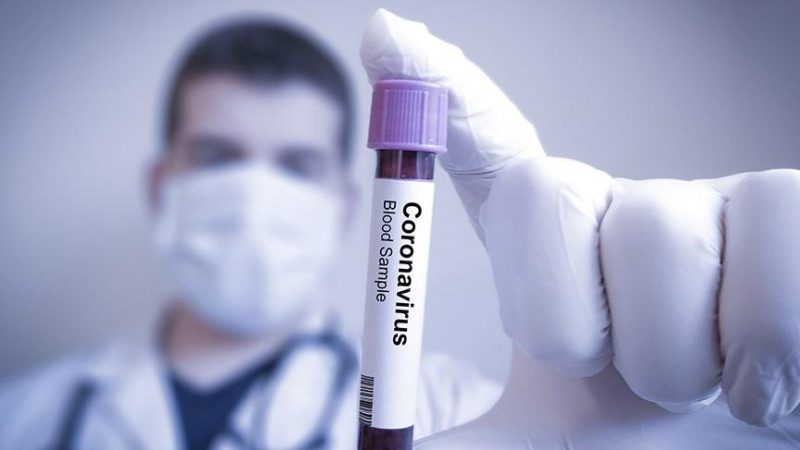 İngiltere Ulusal Sağlık Servisi (NHS) tarafından yapılan açıklamaya göre 18