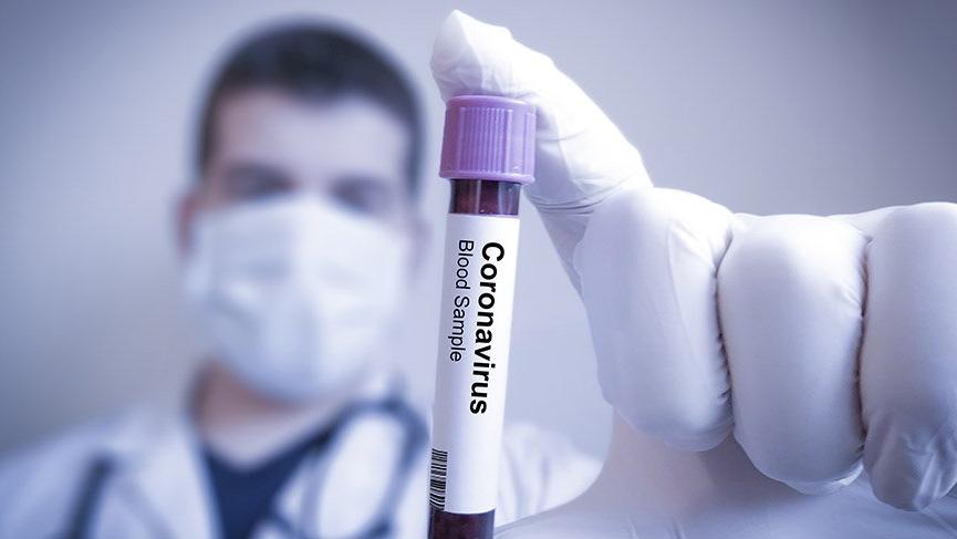 Meclis Hastanesi’nde görevli doktorun ikinci koronavirüs testi pozitif çıktı