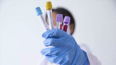 Rusya’da koronavirüs kabusu yeni mi başlıyor?