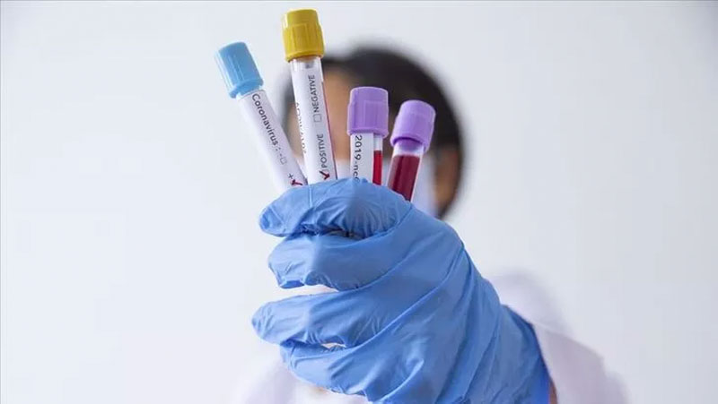 Koronavirüs testleriyle ilgili kritik uyarı! Negatif çıkıyor ama…