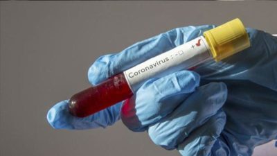 İşte Türkiye’de koronavirüsten ölen kişilerin yaş ortalaması