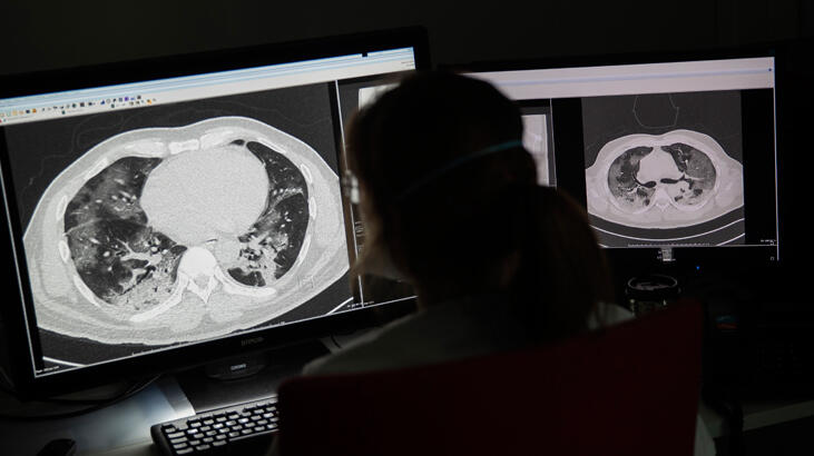 Müjdeli haber geldi! Türkiye’den korona için flaş adım