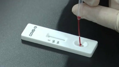 Bursa’da bütün takım test kiti bekliyor…