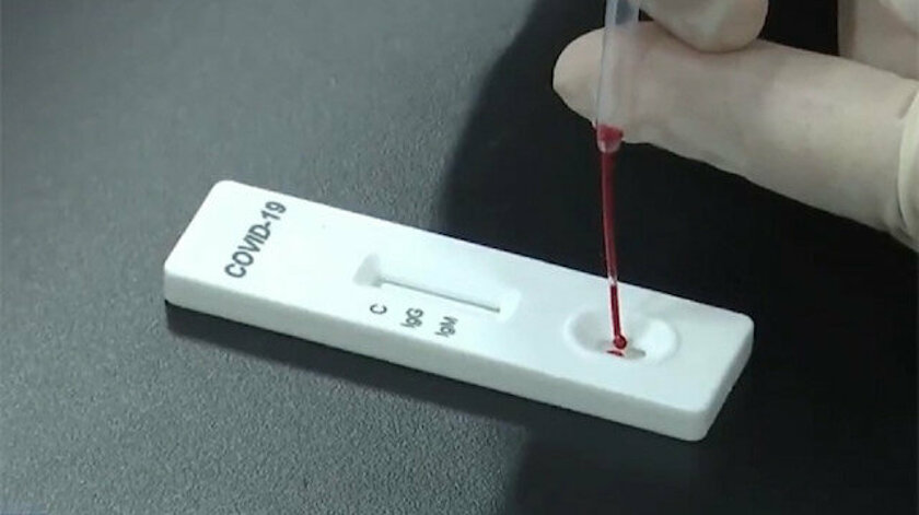 Bursa’da bütün takım test kiti bekliyor… Bursa’da bütün takım test kiti bekliyor…