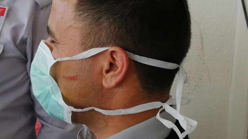 Koronavirüs şüphelisi dehşet saçtı Koronavirüs şüphelisi dehşet saçtı