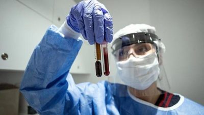 Dr. Yağcı açıkladı! Corona Ramazan Bayramı’nda…