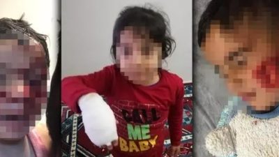 6 çocuğu paramparça ettiler: 3’ünün durumu ağır