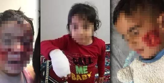 6 çocuğu paramparça ettiler: 3’ünün durumu ağır