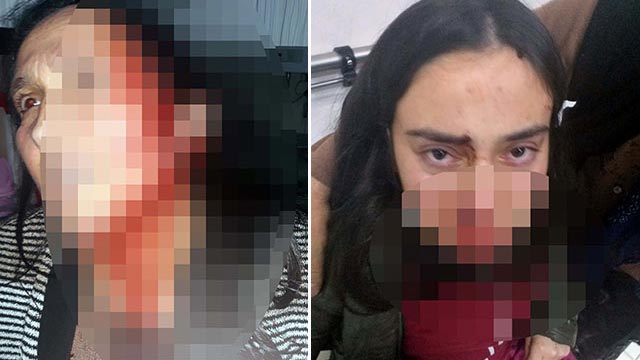 ‘Bizi öldürecek, sesimizi ölmeden duyun’