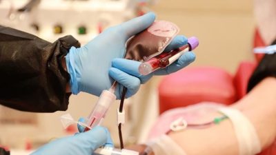 Türkiye’deki ilk plazma tedavisi yapılan hastanın son durumu