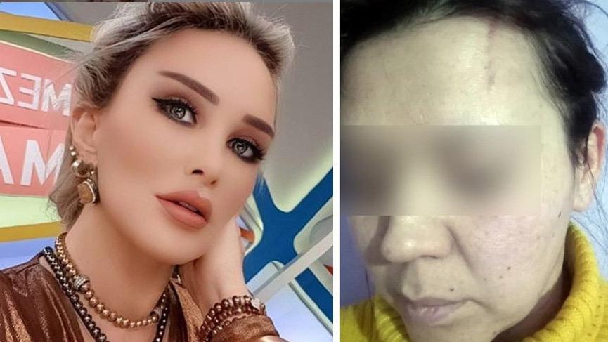 Darp iddiası hakkında Seren Serengil’den açıklama