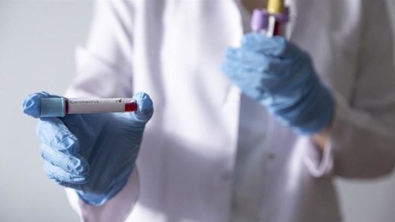 6 yeni koronavirüs türü keşfedildi Yarasalar üzerinde araştırmalar yapan bilim insanları 6 yeni koronavirüs türü