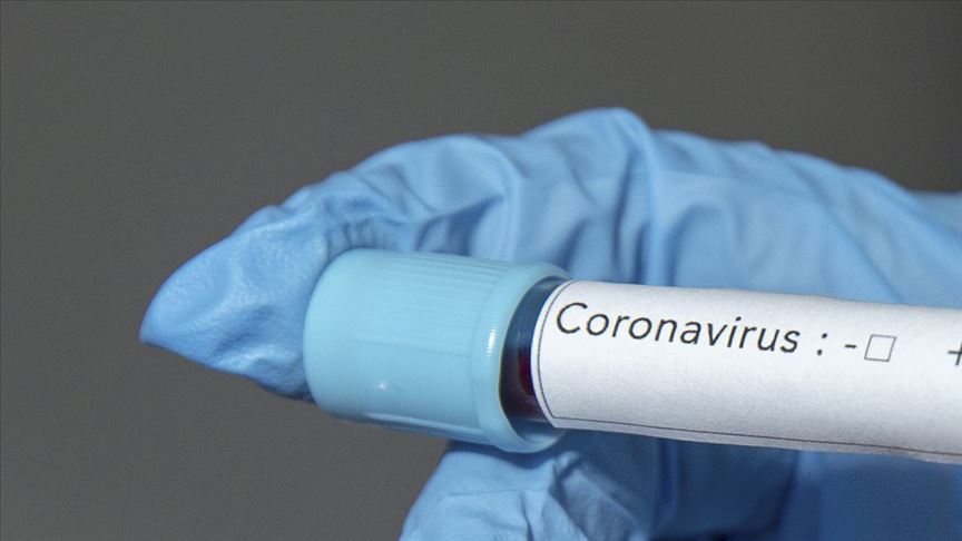 ABD’de koronavirüsten ölenlerin sayısı 67 bini geçti