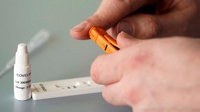 20 dakikada virüs testi