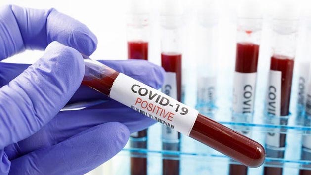 Beşiktaş’ta 8 kişinin koronavirüs testi pozitif çıktı! Ahmet Nur Çebi pozitif… Beşiktaş’ta 8 kişinin koronavirüs testi pozitif çıktı! Ahmet Nur Çebi pozitif…