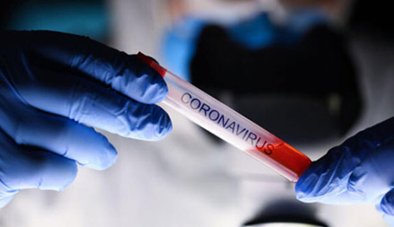 Bursa’da 8 apartmanda uygulanan karantina süreci sona erdi Bursa’da 8 apartmanda uygulanan karantina süreci sona erdi