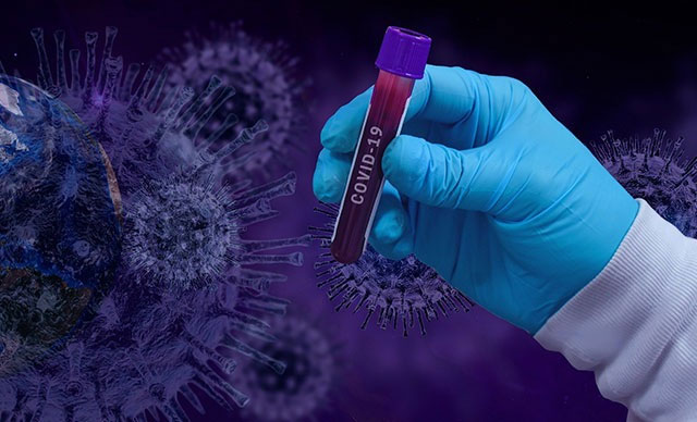 Bilim Kurulu Üyesi’nden ‘ikinci dalga’ uyarısı Bilim Kurulu Üyesi’nden ‘ikinci dalga’ uyarısı