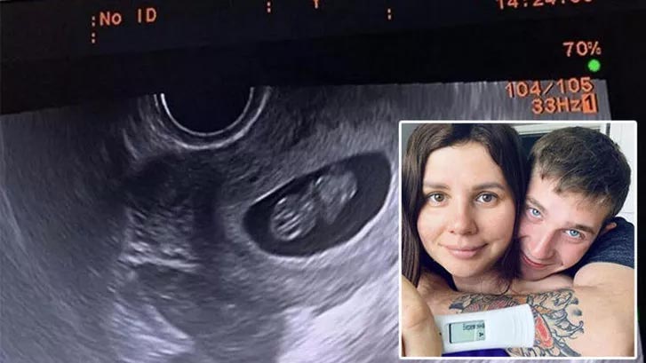 Üvey oğlundan hamile kalan kadından skandal paylaşım!