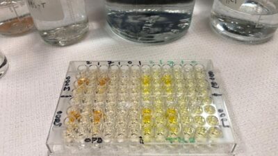 11 riskli grup açıklandı! Bu hastalığı olanlar dikkat!