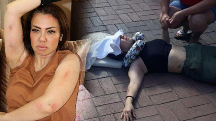 Ünlü şarkıcı ölümden döndü! O anları anlattı… Ünlü şarkıcı ölümden döndü! O anları anlattı…