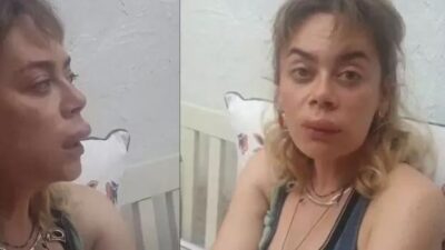 Demet Evgar: Dolgu yaptırdım, gayet doğal oldu