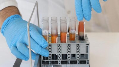 Bir ilimizde başladı! Test uygulaması ile gizli corona virüs pozitifler tespit edilecek