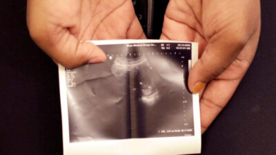 Tecavüzden hamile kaldı, kürtaj talebi reddedildi!