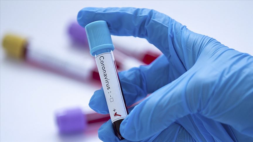 Bursalı işadamı koronavirüsten hayatını kaybetti