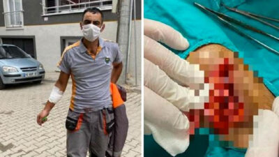 İnegöl’de temizlik işçisi çöp toplarken yaralandı, başkan tepki gösterdi