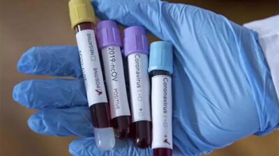 Koronavirüsle ilgili yeni bilgi: Bunu yaşayanlara test yapılmalı