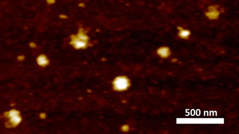 Türk bilim insanları başardı! İşte koronavirüsün mikroskobik görüntüleri…