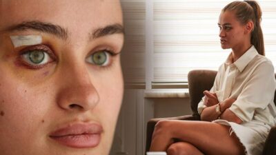 Ukraynalı model Daria Kyryliuk darp iddiasıyla ilgili konuştu